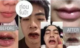 整容男网红吃瓜事件,揭秘网络红人背后的真相与争议